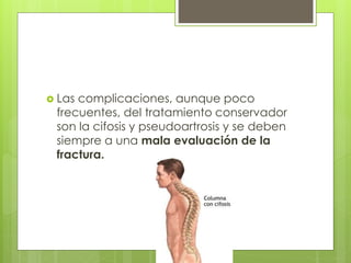  Las complicaciones, aunque poco
frecuentes, del tratamiento conservador
son la cifosis y pseudoartrosis y se deben
siempre a una mala evaluación de la
fractura.
 