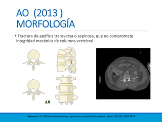 AO (2013 )
MORFOLOGÍA
 Fractura de apófisis transversa o espinosa, que no compromete
integridad mecánica de columna vertebral.
Vaccaro, A. R. AOSpine thoracolumbar spine injury classification system. Spine, 38 (23), 2028-2037.
 