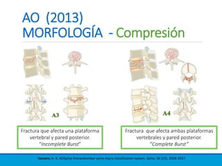 AO (2013)
MORFOLOGÍA - Compresión
Vaccaro, A. R. AOSpine thoracolumbar spine injury classification system. Spine, 38 (23), 2028-2037.
Fractura que afecta una plataforma
vertebral y pared posterior.
“Incomplete Burst”
Fractura que afecta ambas plataformas
vertebrales y pared posterior.
“Complete Burst”
 