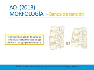 AO (2013)
MORFOLOGÍA - Banda de tensión
Vaccaro, A. R. AOSpine thoracolumbar spine injury classification system. Spine, 38 (23), 2028-2037.
Hiperextensión: Lesión de banda de
tensión anterior por cuerpo o disco
vertebral. Visagra posterior intacta.
 