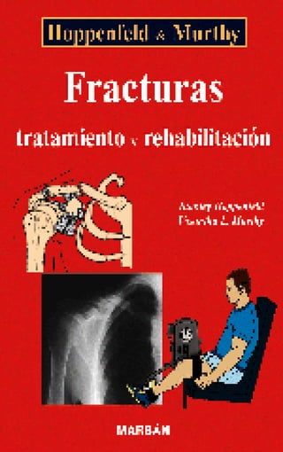Fracturas, tratamiento y rehabilitacion   hoppendfeld-murphy-01