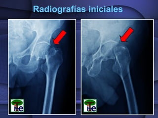 Radiografías iniciales

 