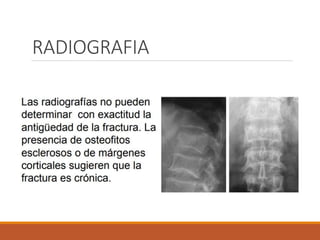 RADIOGRAFIA
 