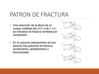 PATRON DE FRACTURA
 