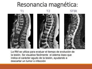 Resonancia magnética:
 