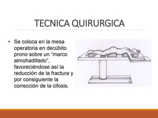 TECNICA QUIRURGICA
 