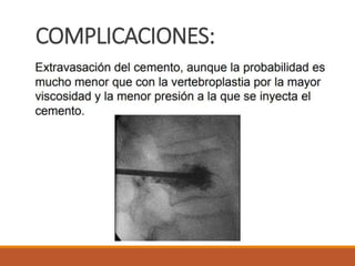 COMPLICACIONES:
 