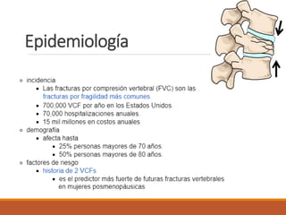 Epidemiología
 