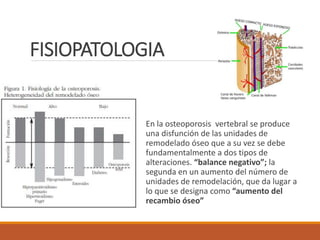 FISIOPATOLOGIA
En la osteoporosis vertebral se produce
una disfunción de las unidades de
remodelado óseo que a su vez se debe
fundamentalmente a dos tipos de
alteraciones. “balance negativo”; la
segunda en un aumento del número de
unidades de remodelación, que da lugar a
lo que se designa como “aumento del
recambio óseo”
 