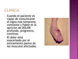  Cuando el paciente es
capaz de comunicarse
el signo mas temprano,
constante y fiable es la
apricion de DOLOR
profundo, progresivo,
continuo.
 El dolor esta
exacerbado por el
estiramiento pasivo de
los musculos afectados.
 