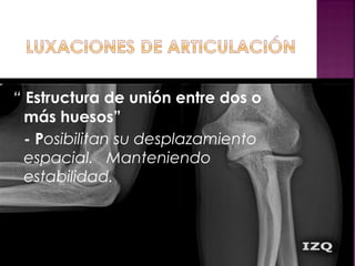 “ Estructura de unión entre dos o
más huesos”
- Posibilitan su desplazamiento
espacial. Manteniendo
estabilidad.
 