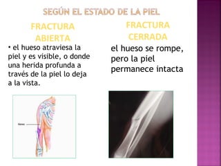 FRACTURA
ABIERTA
• el hueso atraviesa la
piel y es visible, o donde
una herida profunda a
través de la piel lo deja
a la vista.
el hueso se rompe,
pero la piel
permanece intacta
FRACTURA
CERRADA
 
