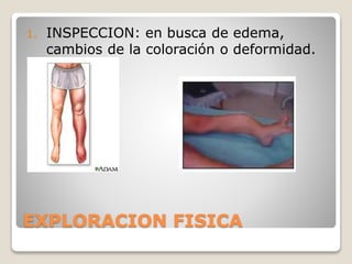 EXPLORACION FISICA
1. INSPECCION: en busca de edema,
cambios de la coloración o deformidad.
 