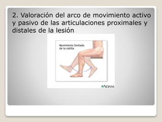 2. Valoración del arco de movimiento activo
y pasivo de las articulaciones proximales y
distales de la lesión
 