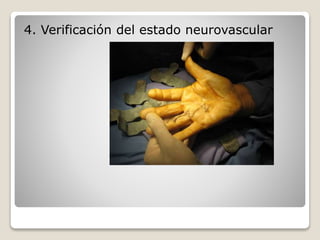 4. Verificación del estado neurovascular
 