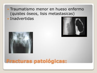 Fracturas patológicas:
 Traumatismo menor en hueso enfermo
(quistes óseos, lisis metastasicas)
 Inadvertidas
 