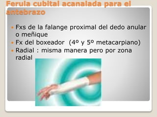 Ferula cubital acanalada para el
antebrazo
 Fxs de la falange proximal del dedo anular
o meñique
 Fx del boxeador (4º y 5º metacarpiano)
 Radial : misma manera pero por zona
radial
 