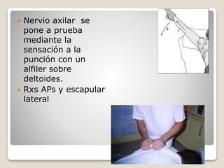  Nervio axilar se
pone a prueba
mediante la
sensación a la
punción con un
alfiler sobre
deltoides.
 Rxs APs y escapular
lateral
 