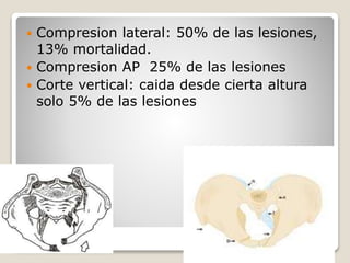  Compresion lateral: 50% de las lesiones,
13% mortalidad.
 Compresion AP 25% de las lesiones
 Corte vertical: caida desde cierta altura
solo 5% de las lesiones
 