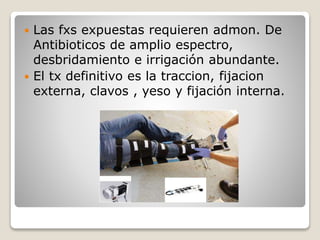  Las fxs expuestas requieren admon. De
Antibioticos de amplio espectro,
desbridamiento e irrigación abundante.
 El tx definitivo es la traccion, fijacion
externa, clavos , yeso y fijación interna.
 