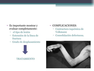 • Es importante mostrar y      • COMPLICACIONES:
  evaluar completamente:         ▫ Contractura isquémica de
  ▫ el tipo de lesión              Volkmann
  ▫ Extensión de la línea de     ▫ Consolidación defectuosa.
    fractura
  ▫ Grado de desplazamiento




        TRATAMIENTO
 