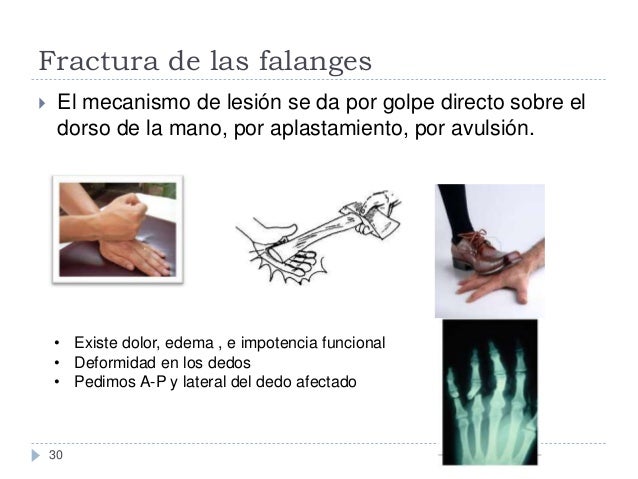 La psoriasis sobre la espalda a los hombres