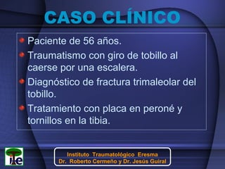 CASO CLÍNICO
Paciente de 56 años.
Traumatismo con giro de tobillo al
caerse por una escalera.
Diagnóstico de fractura trimaleolar del
tobillo.
Tratamiento con placa en peroné y
tornillos en la tibia.
Instituto Traumatológico Eresma
Dr. Roberto Cermeño y Dr. Jesús Guiral