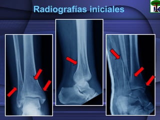 Radiografías iniciales