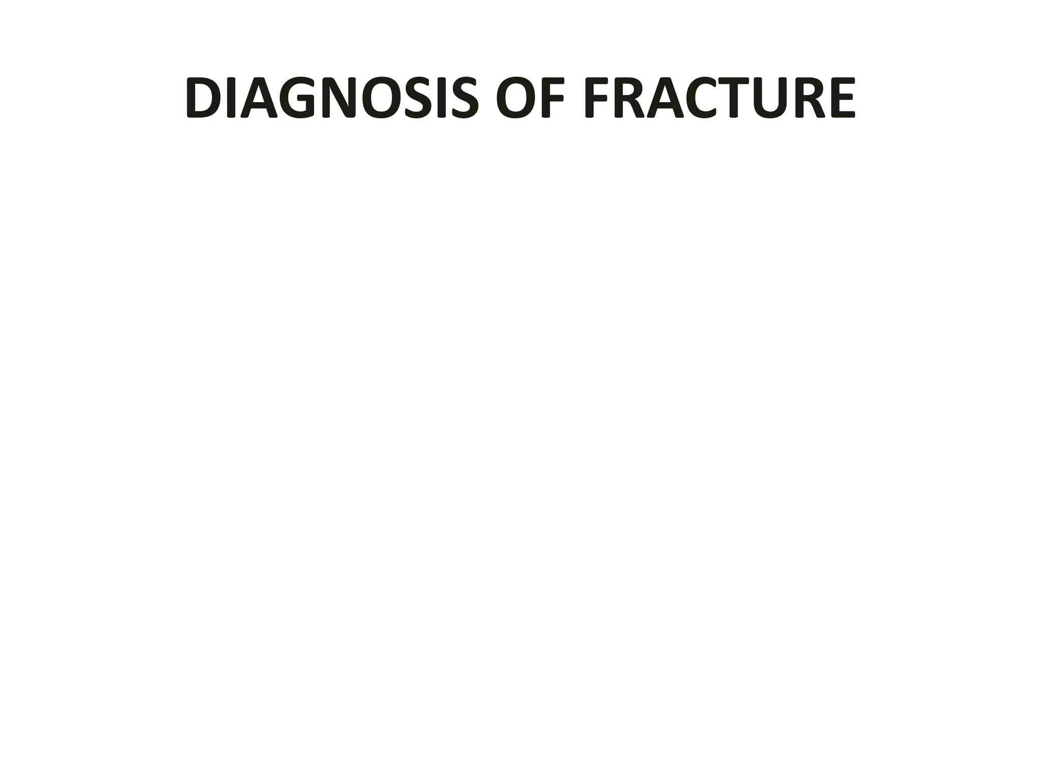 DIAGNOSIS OF FRACTURE
 