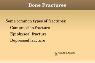 Bone Fractures ,[object Object]