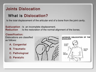  What is Dislocation?
Joints Dislocation
 Is the total displacement of the articular end of a bone from the joint cavity.
Subluxation : Is an incomplete displacement.
Reduction : Is the restoration of the normal alignment of the bones.
 Classification:
Dislocations are classified
as follows:
A. Congenital
B. Traumatic
C. Pathological
D. Paralytic
 