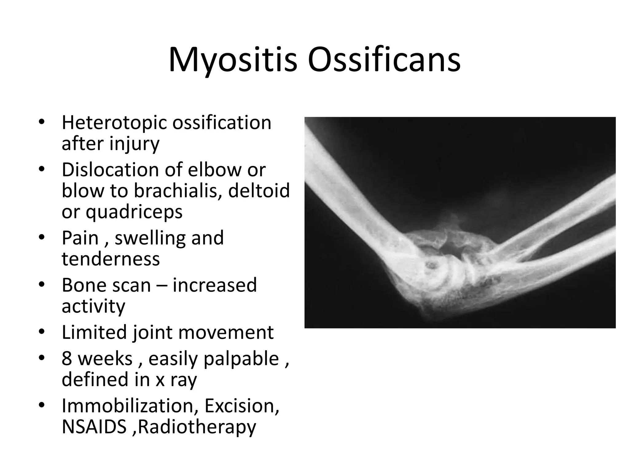 Myositis Ossificans
• Heterotopic ossification
after injury
• Dislocation of elbow or
blow to brachialis, deltoid
or quadriceps
• Pain , swelling and
tenderness
• Bone scan – increased
activity
• Limited joint movement
• 8 weeks , easily palpable ,
defined in x ray
• Immobilization, Excision,
NSAIDS ,Radiotherapy
 