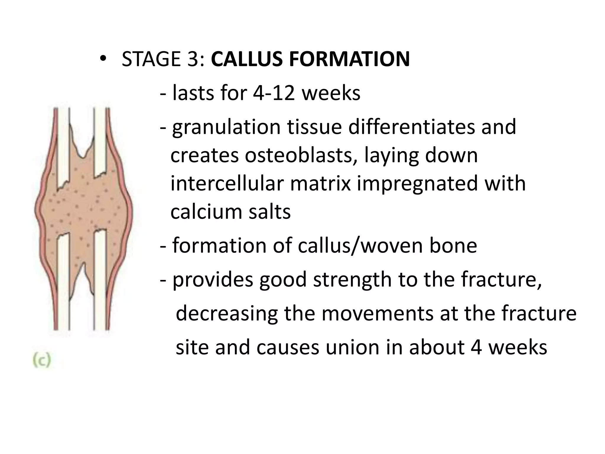 • STAGE 3: CALLUS FORMATION
- lasts for 4-12 weeks
- granulation tissue differentiates and
creates osteoblasts, laying down
intercellular matrix impregnated with
calcium salts
- formation of callus/woven bone
- provides good strength to the fracture,
decreasing the movements at the fracture
site and causes union in about 4 weeks
 