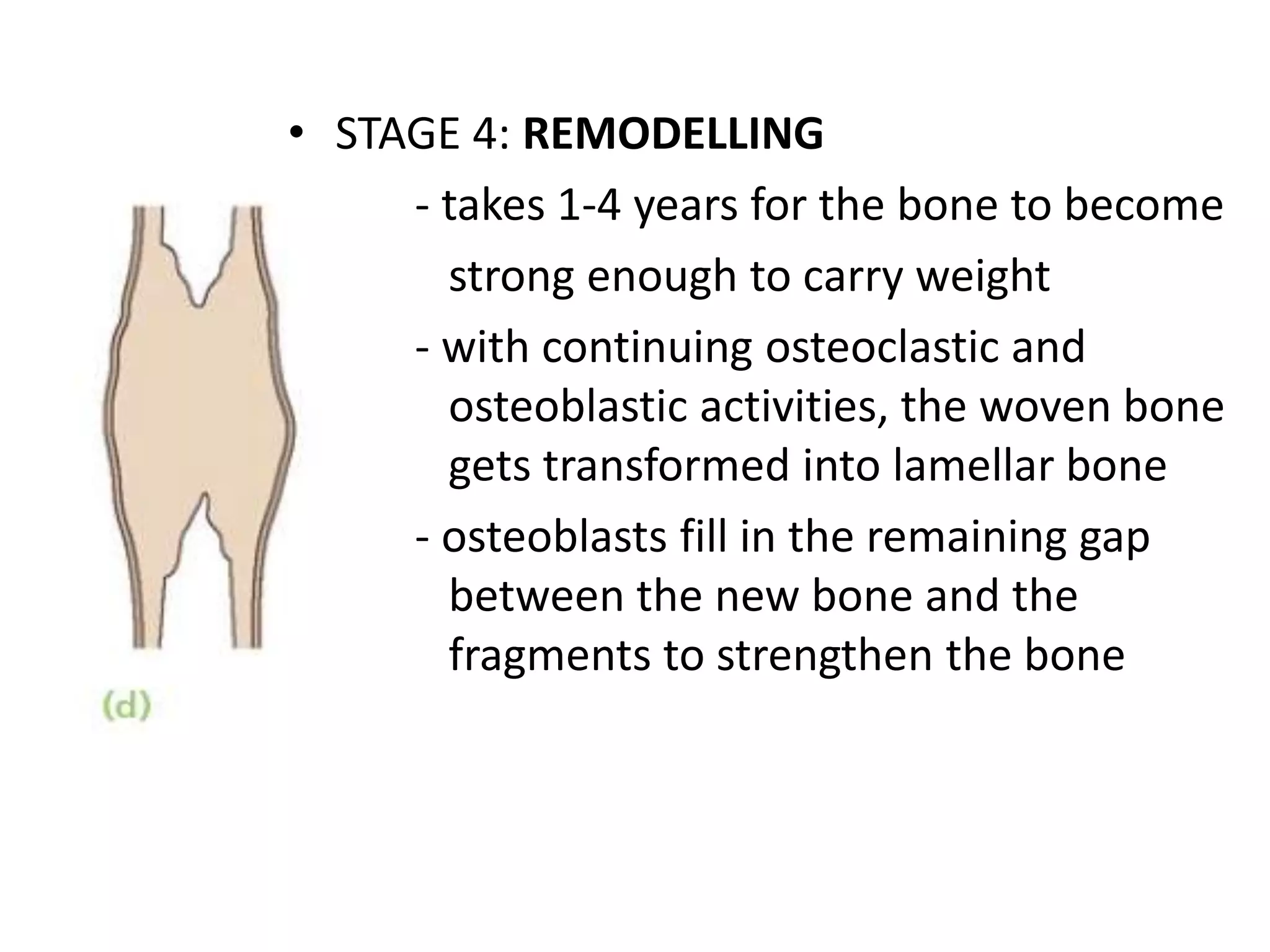 • STAGE 4: REMODELLING
- takes 1-4 years for the bone to become
strong enough to carry weight
- with continuing osteoclastic and
osteoblastic activities, the woven bone
gets transformed into lamellar bone
- osteoblasts fill in the remaining gap
between the new bone and the
fragments to strengthen the bone
 