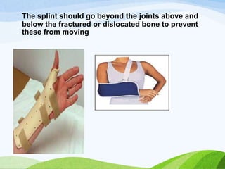 The splint should go beyond the joints above and
below the fractured or dislocated bone to prevent
these from moving
 