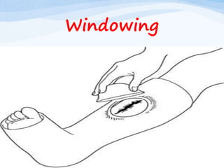 Windowing
 