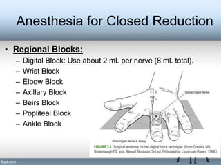 CONSERVATIVE MANAGEMENT OF FRACTURE | PPT