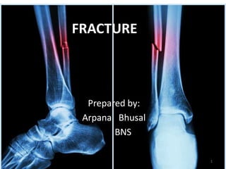 1
Prepared by:
Arpana Bhusal
BNS
FRACTURE
 