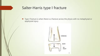 Salter-Harris type I fracture
 Type I fracture is when there is a fracture across the physis with no metaphysial or
epiphysial injury
 