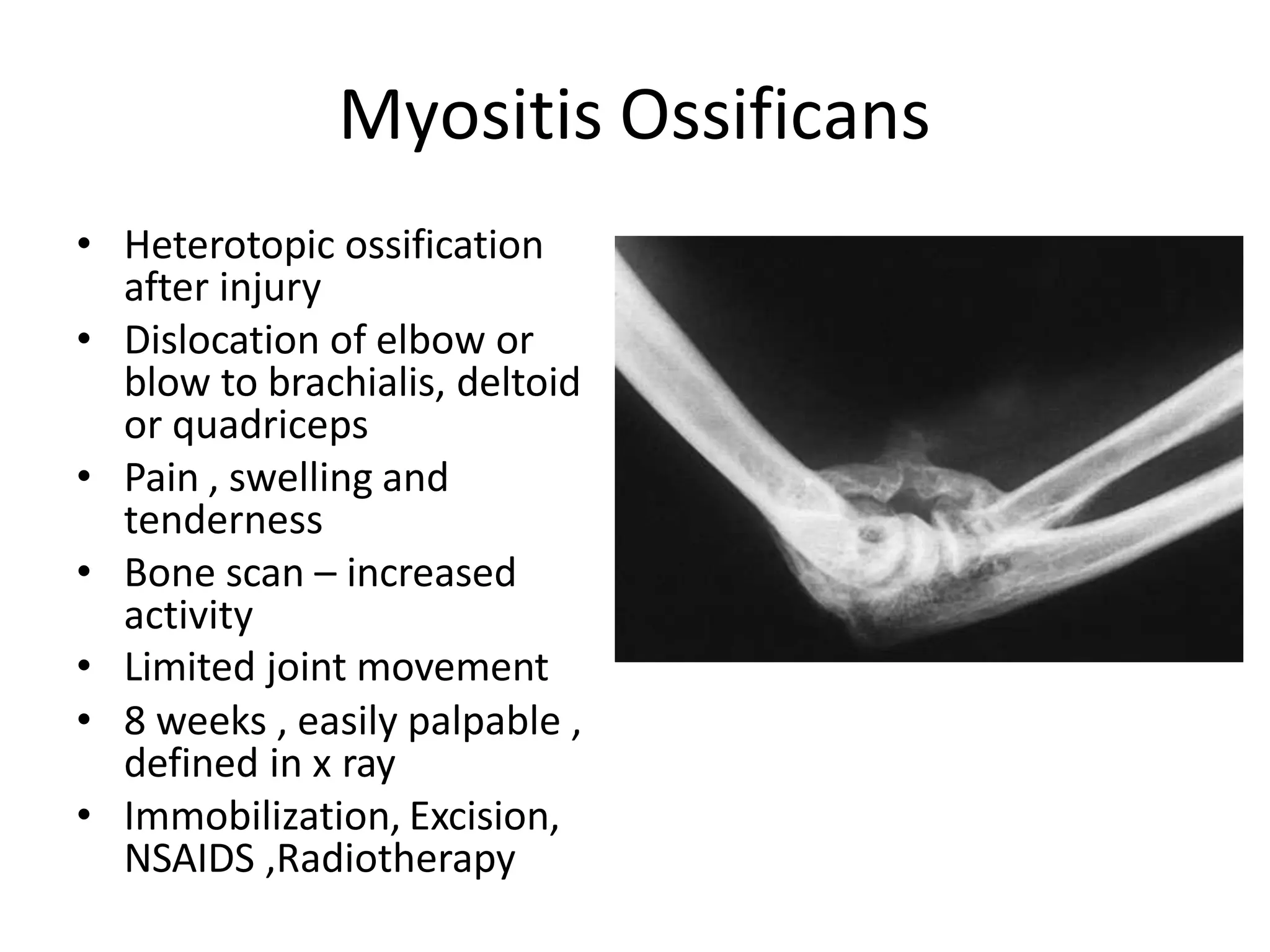 Myositis Ossificans
• Heterotopic ossification
after injury
• Dislocation of elbow or
blow to brachialis, deltoid
or quadriceps
• Pain , swelling and
tenderness
• Bone scan – increased
activity
• Limited joint movement
• 8 weeks , easily palpable ,
defined in x ray
• Immobilization, Excision,
NSAIDS ,Radiotherapy
 