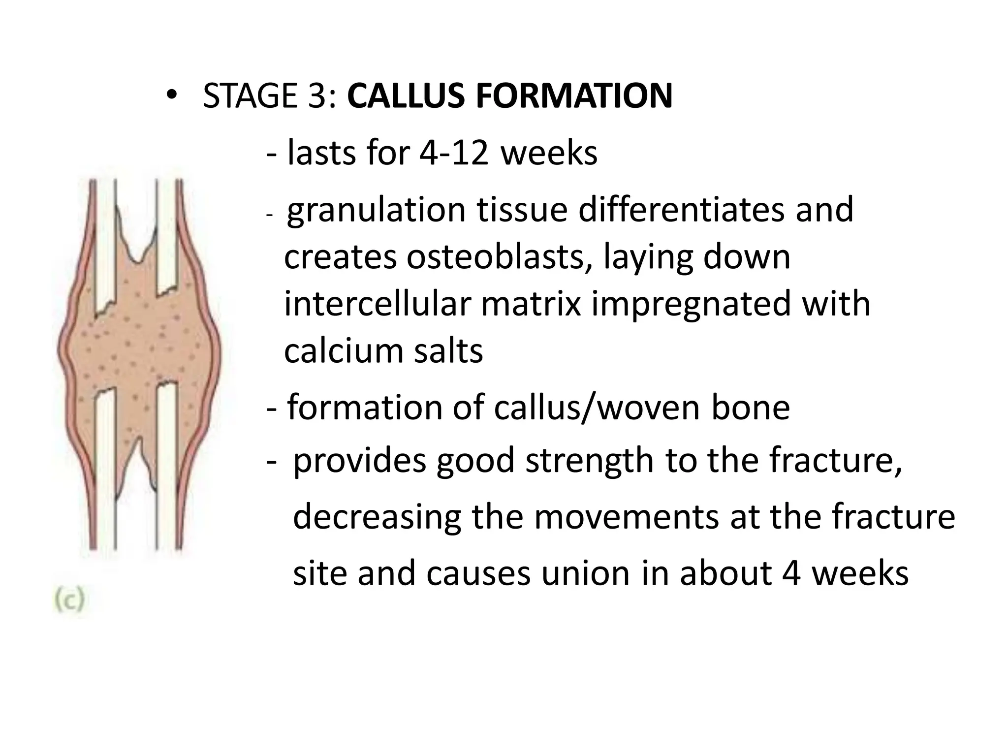 • STAGE 3: CALLUS FORMATION
- lasts for 4-12 weeks
- granulation tissue differentiates and
creates osteoblasts, laying down
intercellular matrix impregnated with
calcium salts
- formation of callus/woven bone
- provides good strength to the fracture,
decreasing the movements at the fracture
site and causes union in about 4 weeks
 