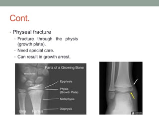 Physes fracture healing in orthopedics in a nutshell.pdf