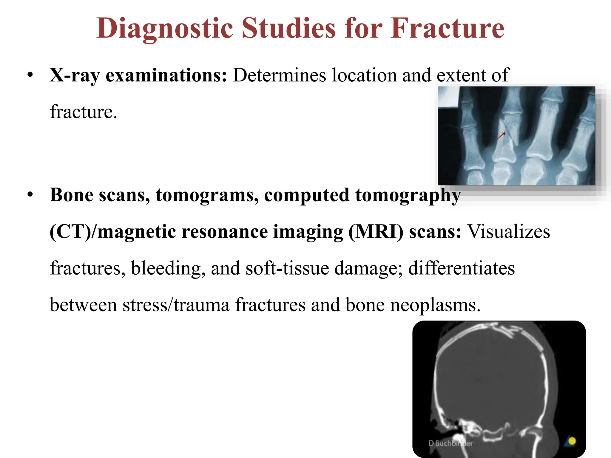 Diagnostic Studies for Fracture
• X-ray examinations: Determines location and extent of
fracture.
• Bone scans, tomograms, computed tomography
(CT)/magnetic resonance imaging (MRI) scans: Visualizes
fractures, bleeding, and soft-tissue damage; differentiates
between stress/trauma fractures and bone neoplasms.
 