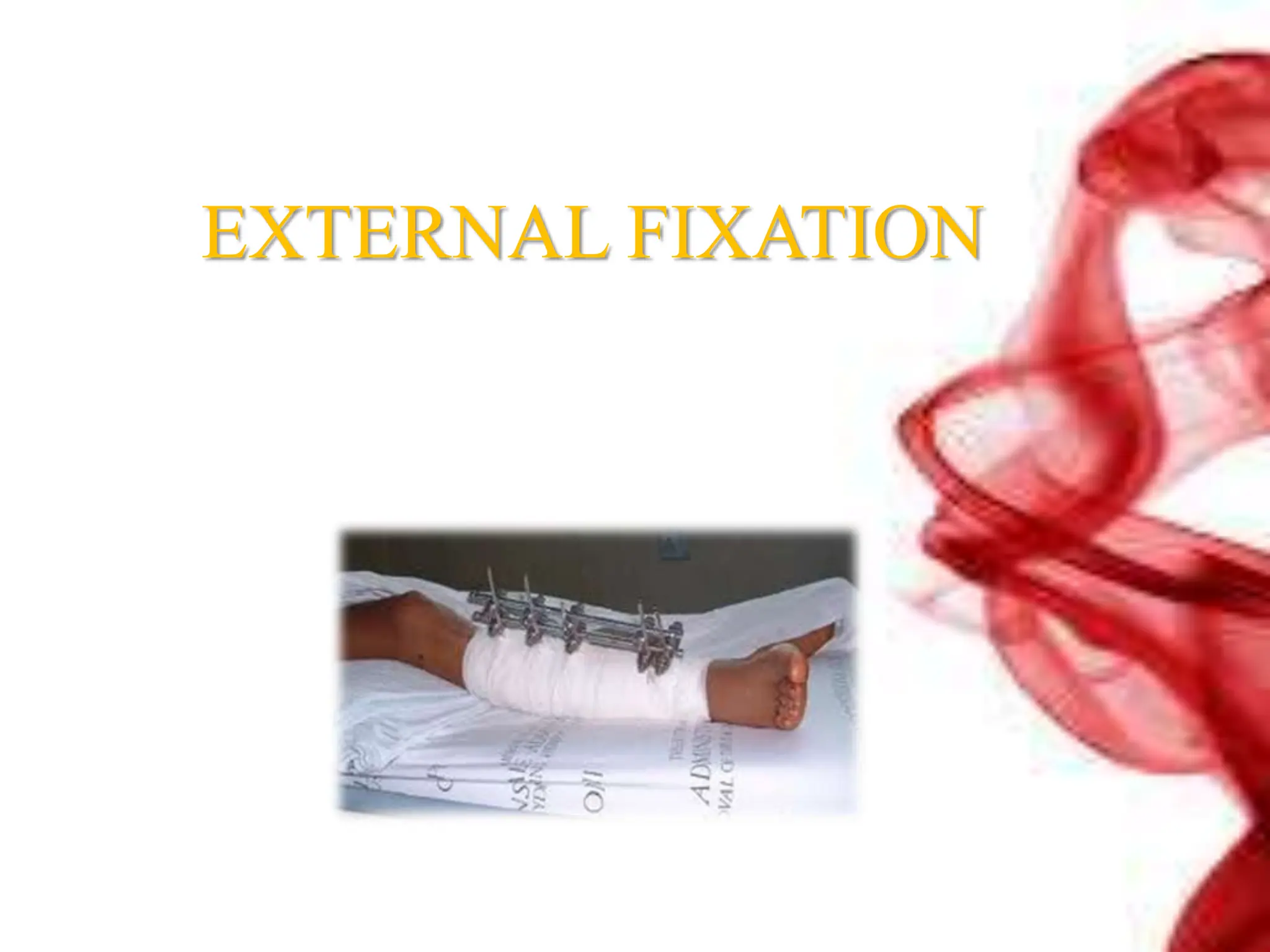 EXTERNAL FIXATION
 