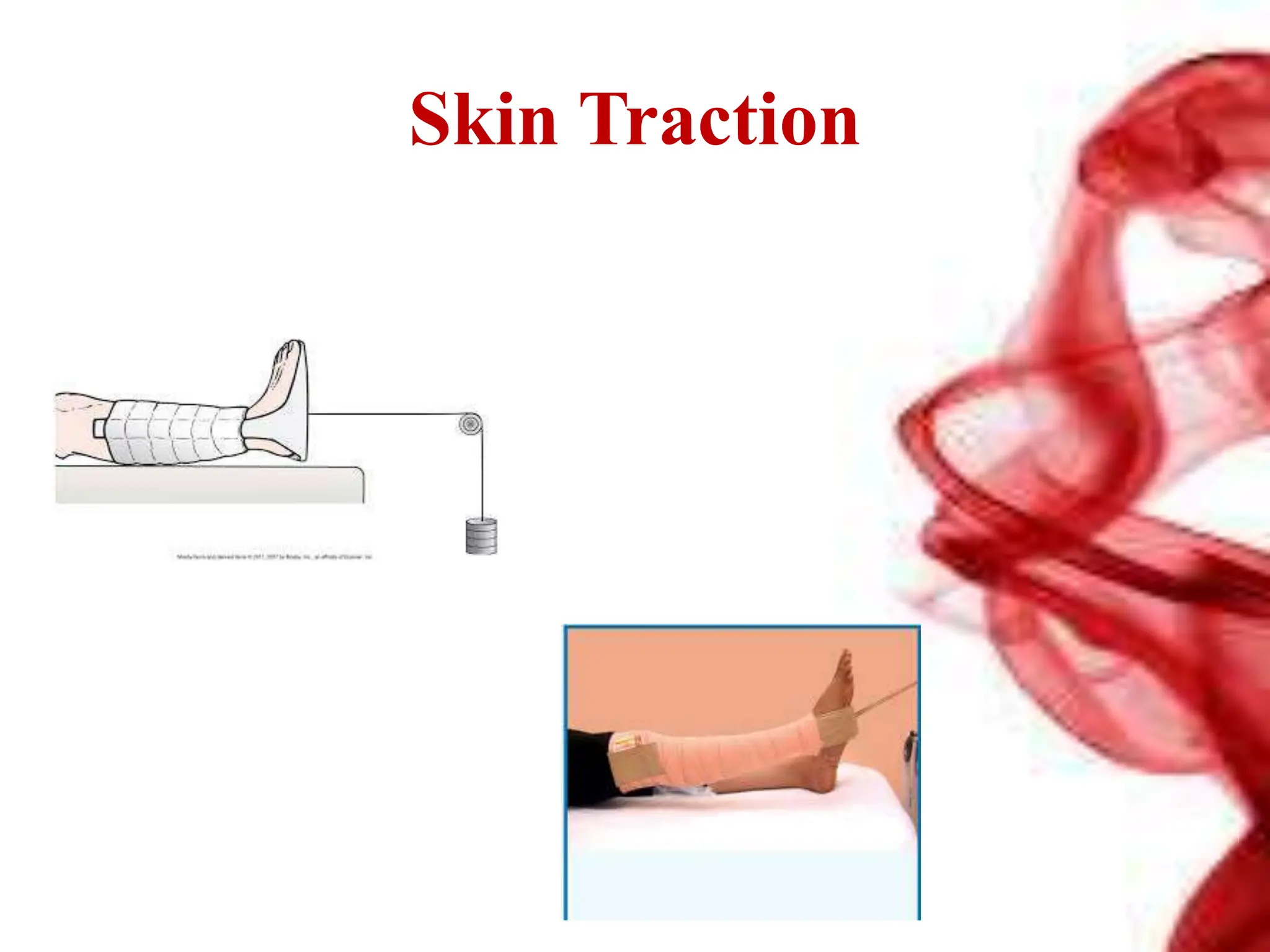 Skin Traction
 