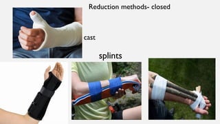 FRACTURE.pptx FIRST AID MANAGEMENT NOTES | PPTX