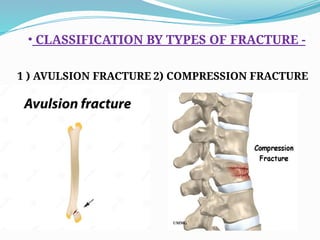 FRACTURE and types of fracture problems .pptx