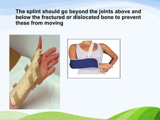 Splint Verbindung fracture-types, symptoms, medical and surgical mgmtmanagement, | PPTX