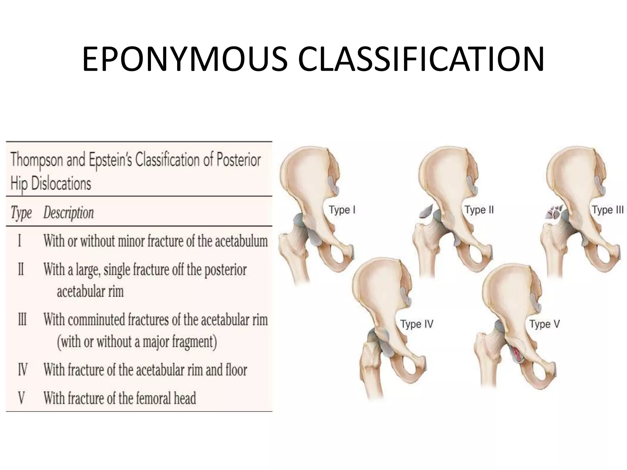 Fracture Rate Classification FRACTURE- Aetiology, Classification and Complications.pptx