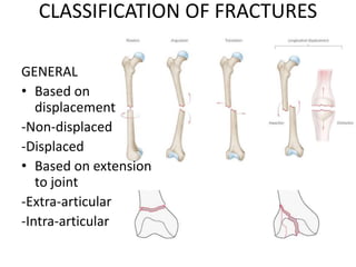 GENERAL
• Based on
displacement
-Non-displaced
-Displaced
• Based on extension
to joint
-Extra-articular
-Intra-articular
CLASSIFICATION OF FRACTURES
 